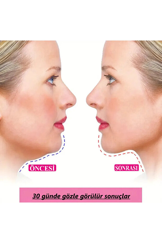 Uyku Yüz Ve Çene Germe Sıkılaştırma Cilt Sıkılaştırma Çift Çene Azaltma Bandı
