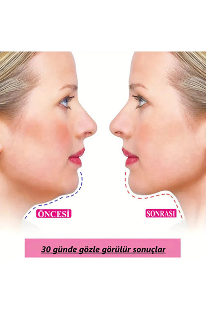 Uyku Yüz Ve Çene Germe Sıkılaştırma Cilt Sıkılaştırma Çift Çene Azaltma Bandı